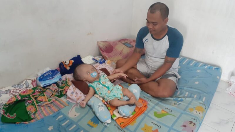 Kasihan, Begini Kisah Bayi di Madiun yang Menderita Hidrosefalus dan Butuh Bantuan