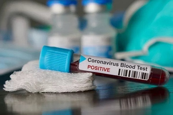 Vaksin Merah Putih Ditargetkan Uji Klinis Awal Tahun Depan